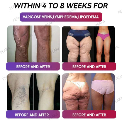𝑂𝑓𝑓𝑖𝑐𝑖𝑎𝑙 𝑆𝑡𝑜𝑟𝑒 | PEAKA® GLP‑1 Slimming Vitality Boost Oral Thin Film 👩‍⚕️🥇(Just once a week, visible changes in 7 days ✅ For obesity, cardiovascular health, diabetes, sleep apnea, joint issues, and more)